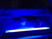 Лампа для лечения желтушки новорожденных,  Фототерапия на дому,  Актау